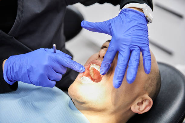 Best Knocked-Out Tooth (Avulsed Tooth) Treatment in Valley View, PA
